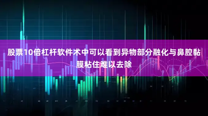 股票10倍杠杆软件术中可以看到异物部分融化与鼻腔黏膜粘住难以去除